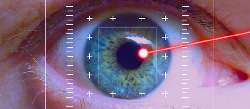 Cirugía lasik